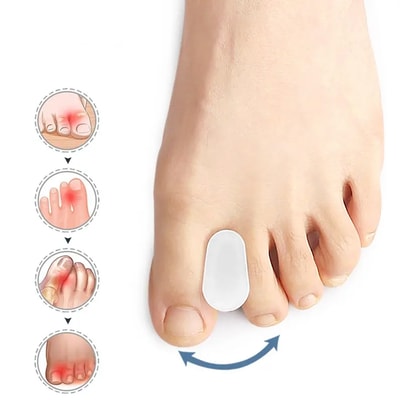Tåspreder for hallux valgus - 2 stk - Separerer tærne for å redusere smerte